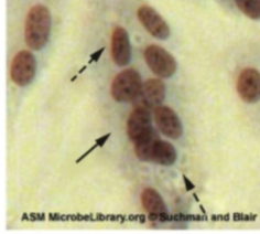 <p>Which type of virus does CPE detect faint basophilic cytoplasmic inclusion bodies </p>