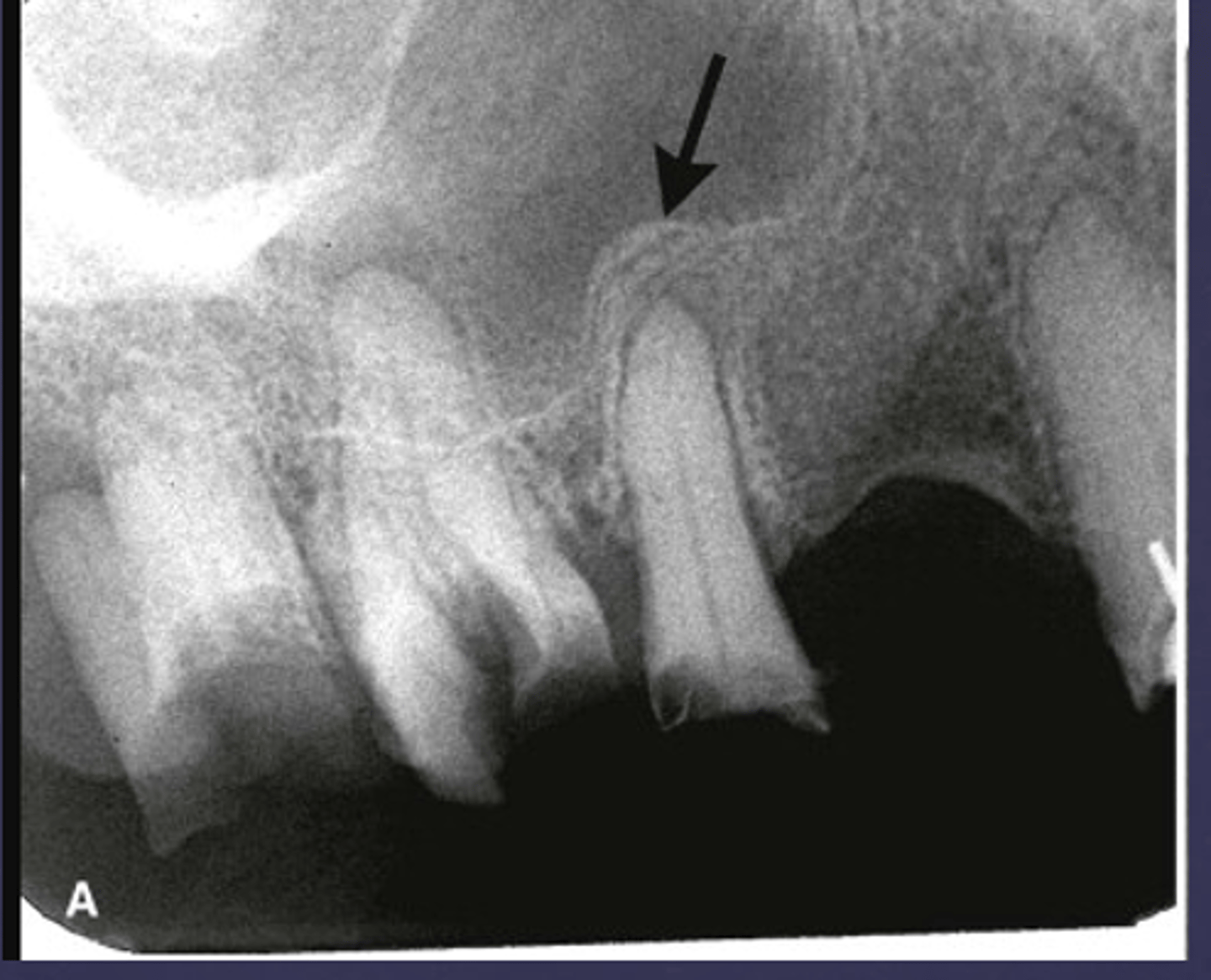 <p>What are the arrows pointing to?</p>