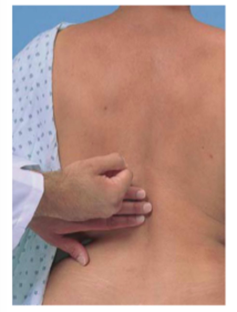 <p>The right kidney is easier to detect, because it is somewhat lower than the left one. In patients with obesity, palpation of the kidneys is more difficult.</p><p>Prone:</p><p>left kidney is palpated by reaching over to the patient's left side and placing the right hand beneath the patient's lower left rib. Push the hand on top forward as the patient inhales deeply.</p>