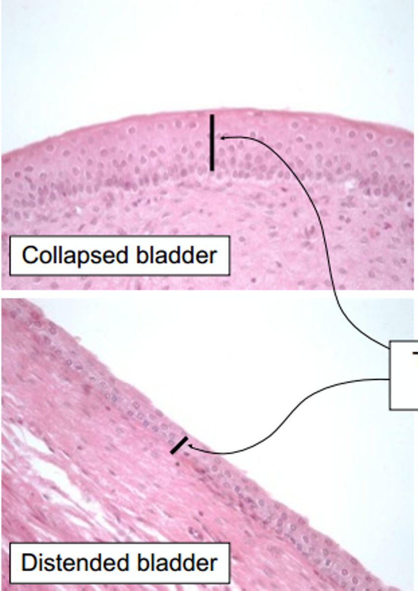 <p>Know distended versus relaxed!</p>