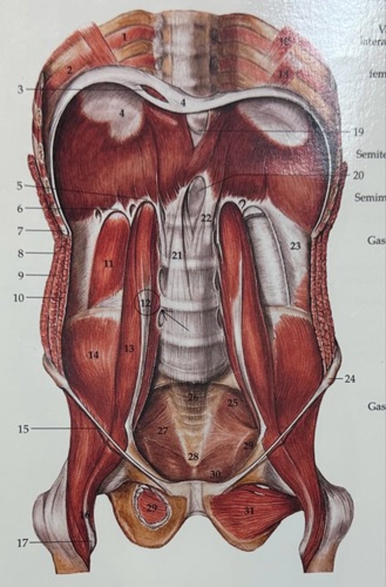 <p>Psoas Minor</p>