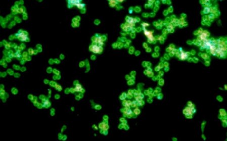 <p>FLUORESCENT ANTIBODY TESTING</p>