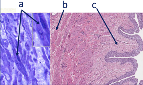 <p>Which image(s) is not/are not composed of long, spindle-shaped smooth muscle cells?</p><p>A</p><p>B</p><p>C</p><p>A and B</p><p>A, B, and C</p>