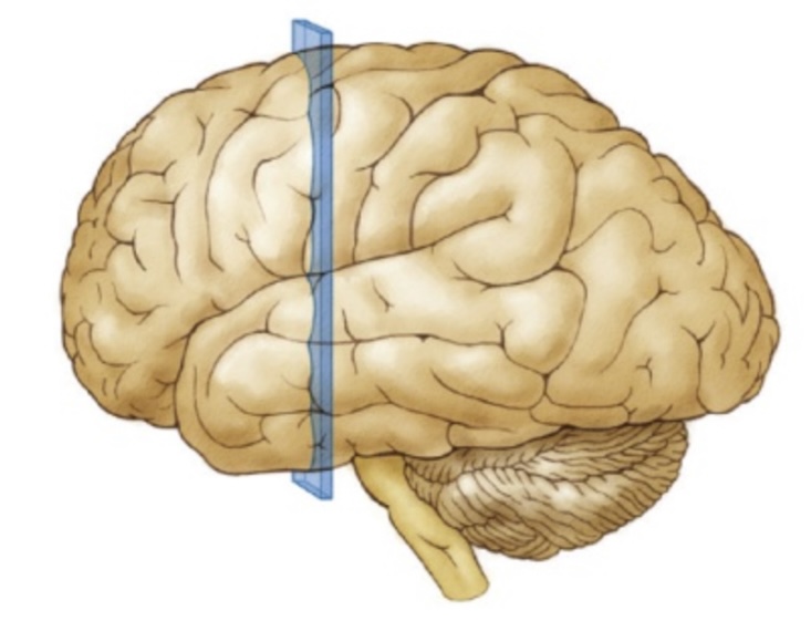 <p>The section cut in a vertical plane from the crown of the head down, revealing a frontal view of the brain.</p>