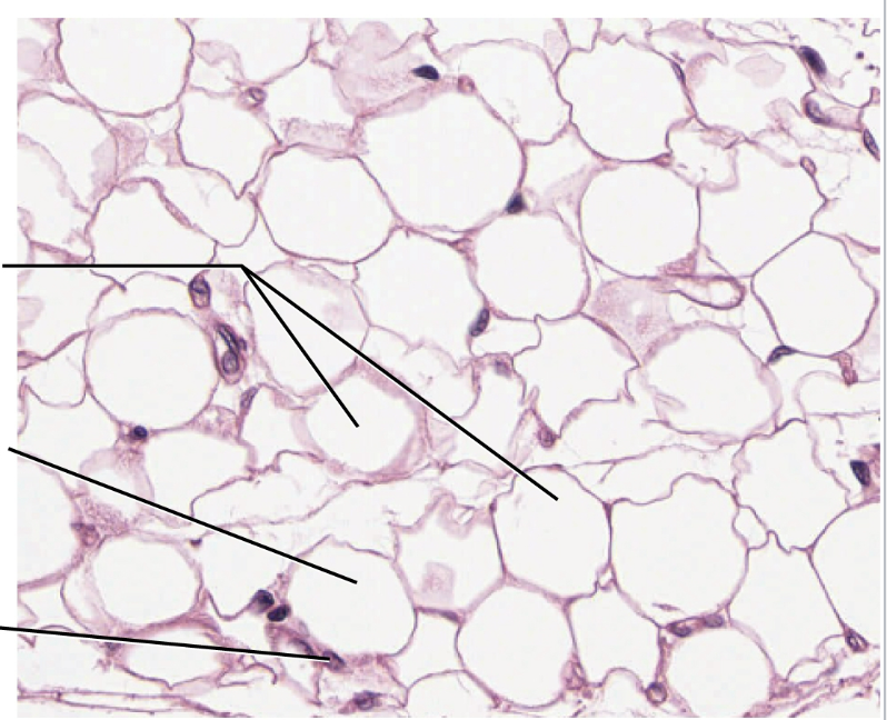 <p>Adipose Connective</p><p>made of adipocytes that <strong>store triglycerides&nbsp;</strong></p><p>Function: supports and protects various organs; good insulator; reserve for energy&nbsp;</p><p>Found in: subcutaneous layer deep to the skin and surrounds organs</p>