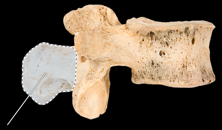 <p>What part of the vertebra is highlighted?</p><p>What type of vertebra is this (which region is this vertebra from)?</p><p>(Lateral view, right side).</p>