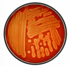 <p>Hemolysis Type?</p>