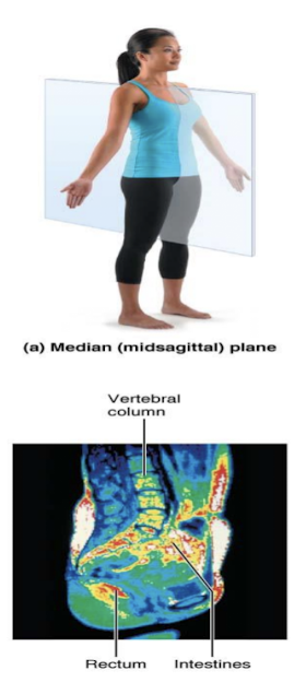 <p>midsagittal median plane</p>