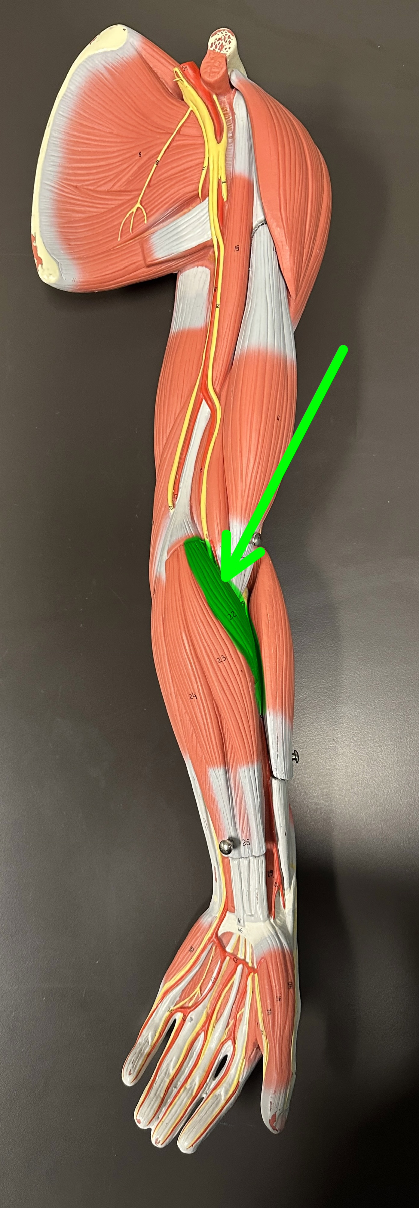 <p>What is the highlighted structure</p>