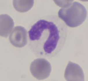 <p>What toxic change has happened in this neutrophil?</p>