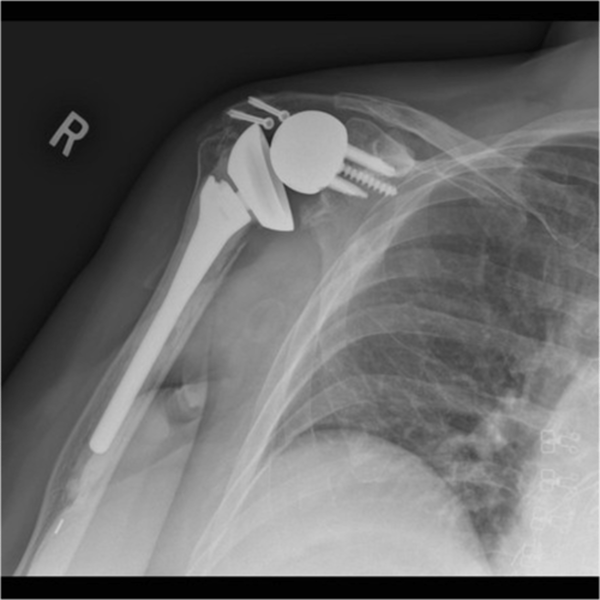 <p>What is this image depicting?</p>