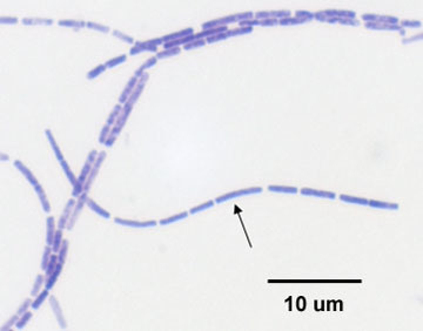 <p>What bacterial arrangement is pictured here?</p>