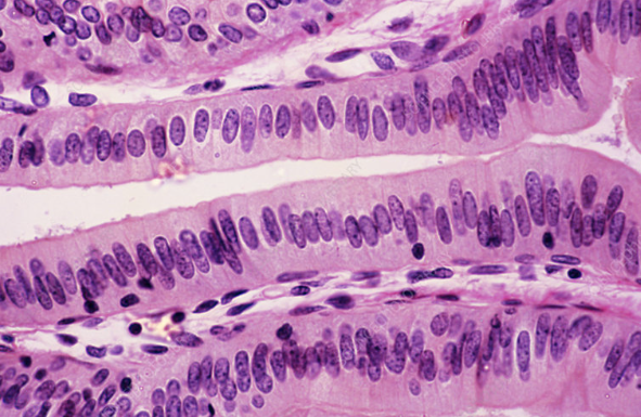 <ul><li><p>line organs (such as the stomach and intestines)</p></li></ul><p></p>