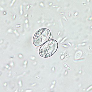 <p>Sarcocystis </p><p>9–16 μm.</p><p></p>