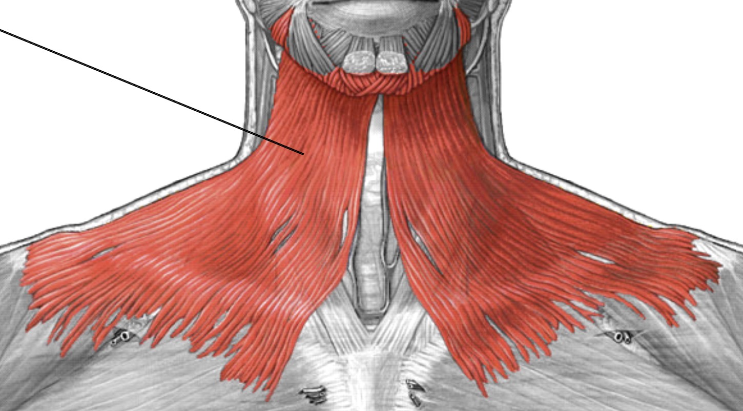 <p>Which anterior muscle of the neck is:</p><ul><li><p>Big sheet on anterior side of neck</p></li><li><p>Action: depress mandible &amp; lower lip</p></li><li><p>Nerve: <span style="color: yellow;">CN VII</span></p></li></ul><p></p>