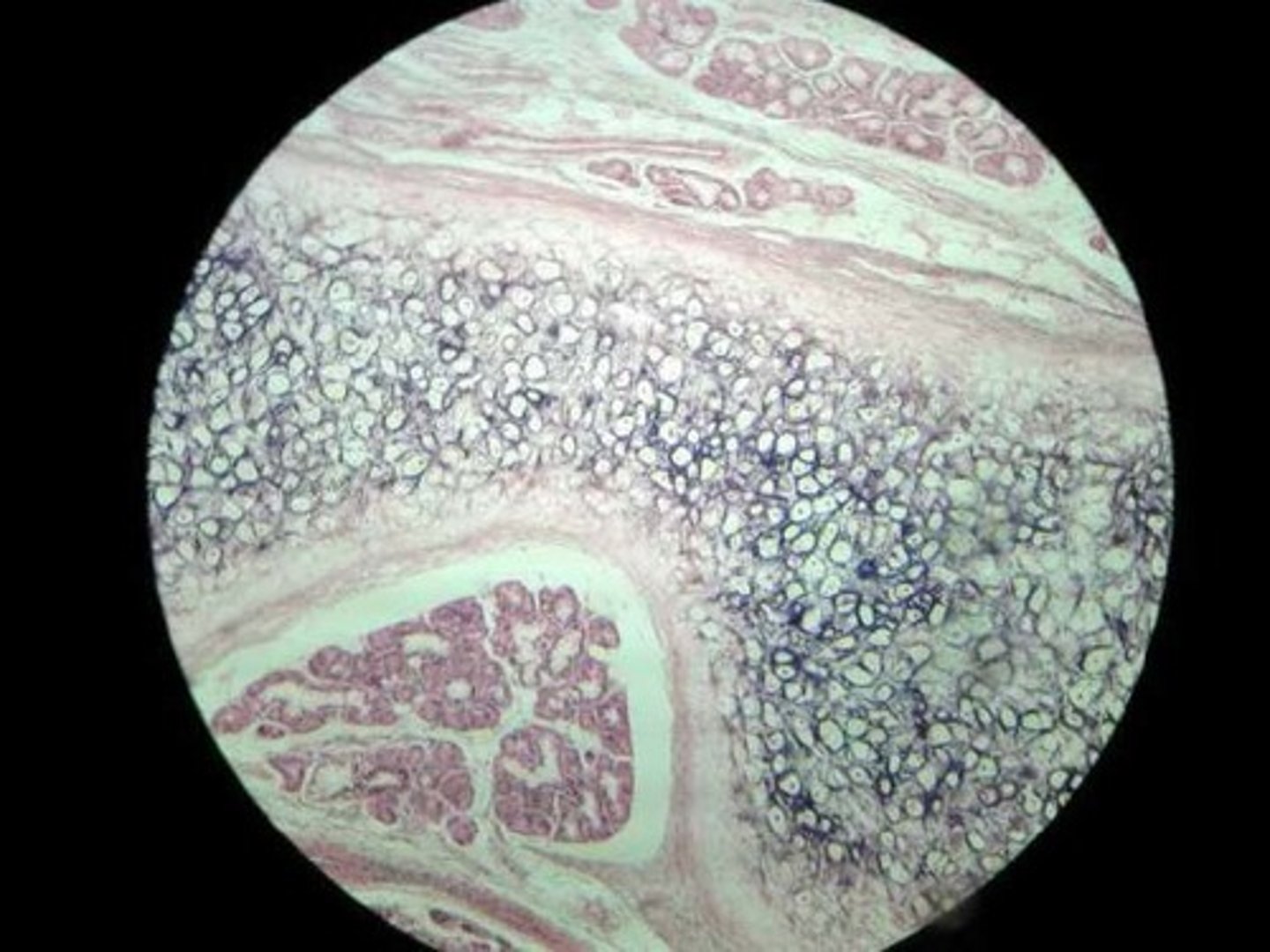 <p>Location: Framework for external ears and parts of the larynx</p><p>Function: Support, protect, and provide a flexible framework (*more compact and smaller than hyaline, usually stain darker)</p>