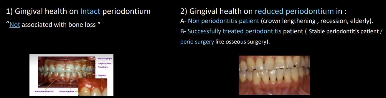 <ul><li><p>Pristine Gingival health: TOTAL absence of clinical inflammation and physiological immune surveillance on periodontium. Not likely observed clinically</p></li><li><p>Clinical periodontal health with intact/reduced periodontium: absence or minimal levels of clinical inflammation in a periodontium with normal support</p><ul><li><p><mark data-color="red" style="background-color: red; color: inherit;">&lt;10% BOP sites with probing depths &lt;_3mm</mark></p></li><li><p>Reduced periodontium non periodontitis patient like crown lengthening, recession, elderly OR successfully treated periodontitis pt that is stable</p></li></ul></li></ul><p></p>