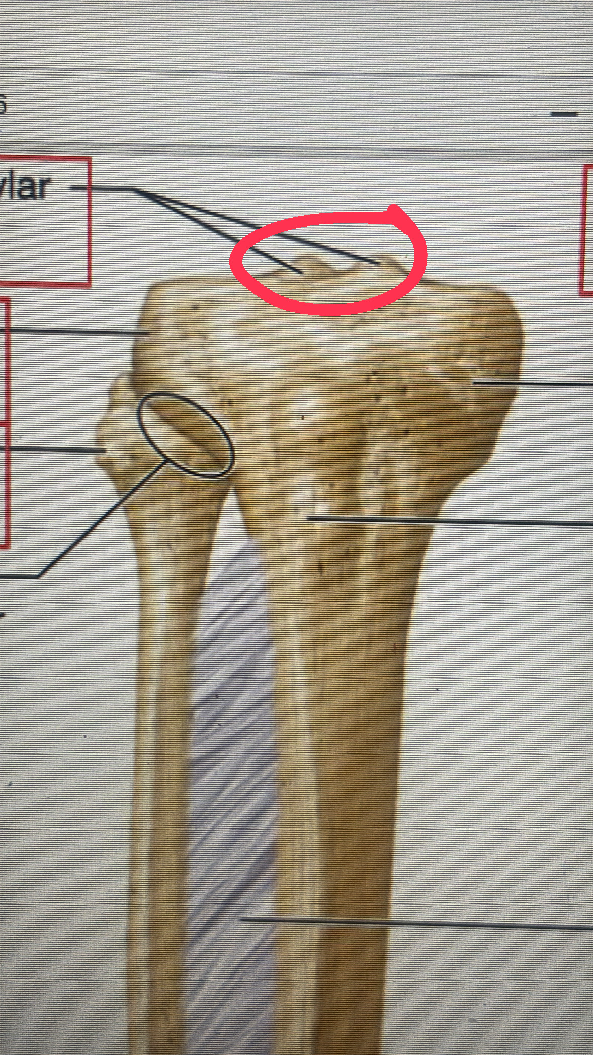 <p>double bumps on top of the tibia</p>