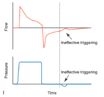 <ul><li><p><span>Involves a patient-generated decrease in airway pressure with a simultaneous increase in airflow without triggering a machine-delivered breath</span></p><ul><li><p><span>Often the result of an inappropriately set sensitivity setting on the ventilator</span></p></li><li><p><span>Increasing levels of pressure support suppress respiratory drive and lead to increased frequency of ineffective triggering</span></p></li><li><p><span>Triggering delay and ineffective triggering are often easier to identify on the flow scalar than on the pressure scalar because of the larger relative change in that parameter (i.e. bigger relative change in flow than pressure with ineffective efforts to trigger inspiration)</span></p></li><li><p><span>When ineffective triggering is detected, look for evidence of an improper triggering threshold, auto-PEEP (PEEPi), significant muscle weakness/fatigue, reduced respiratory drive, or an excessively deep level of anesthesia</span></p></li></ul></li></ul><p></p>