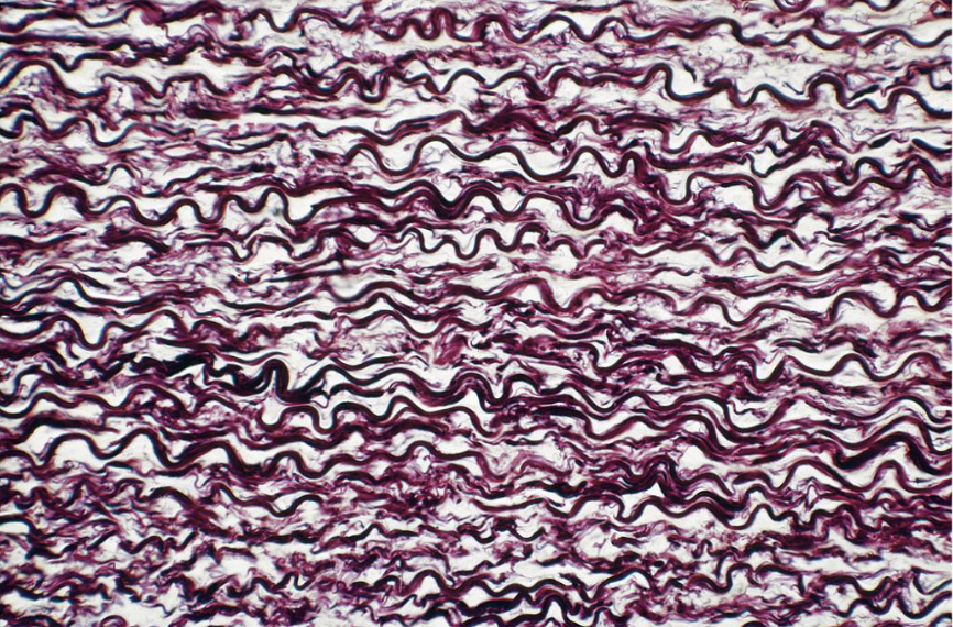 <p>what tissue is this&nbsp;</p>