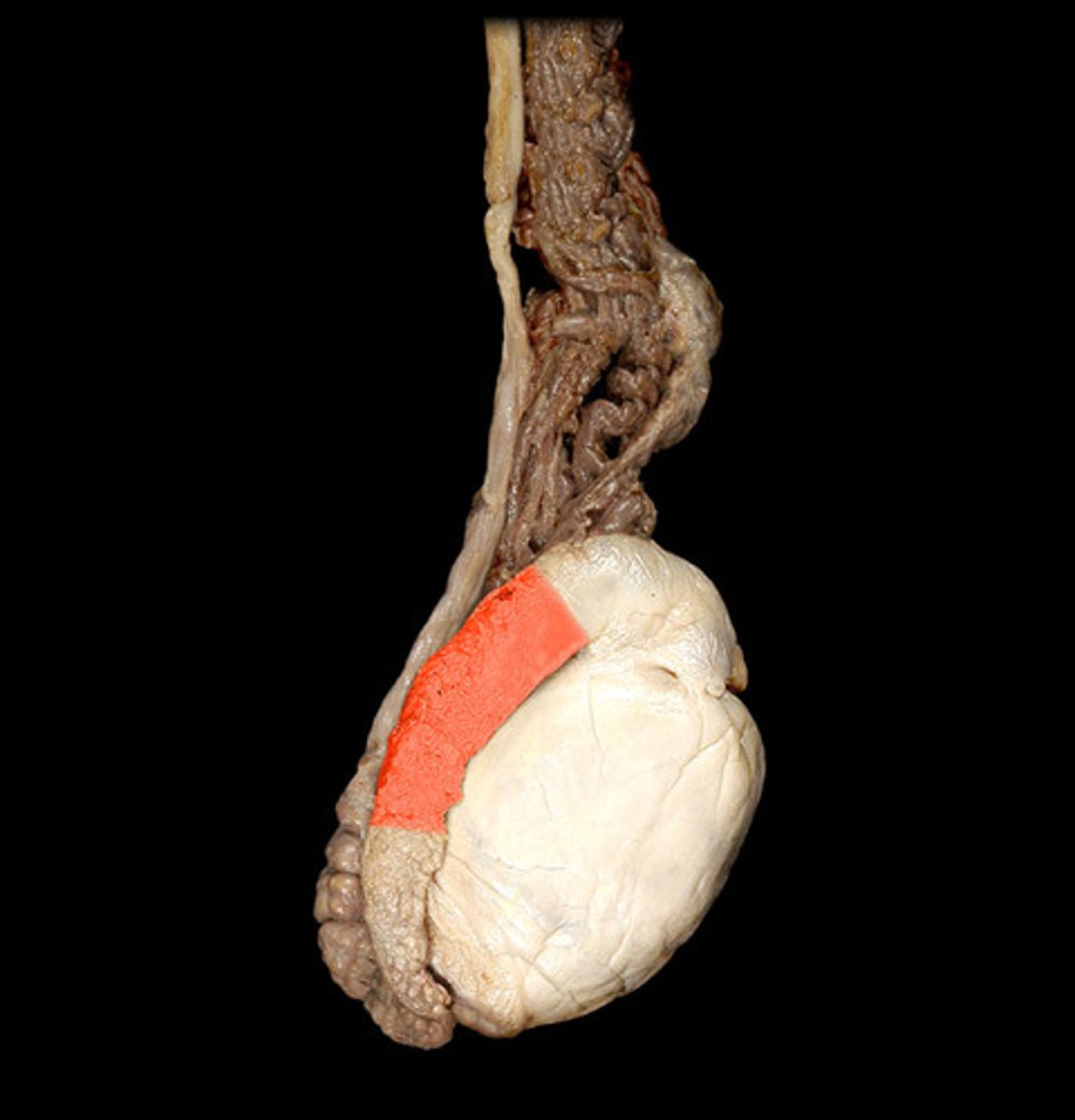 <p>From last efferent ductule to posterior margin of testis</p>