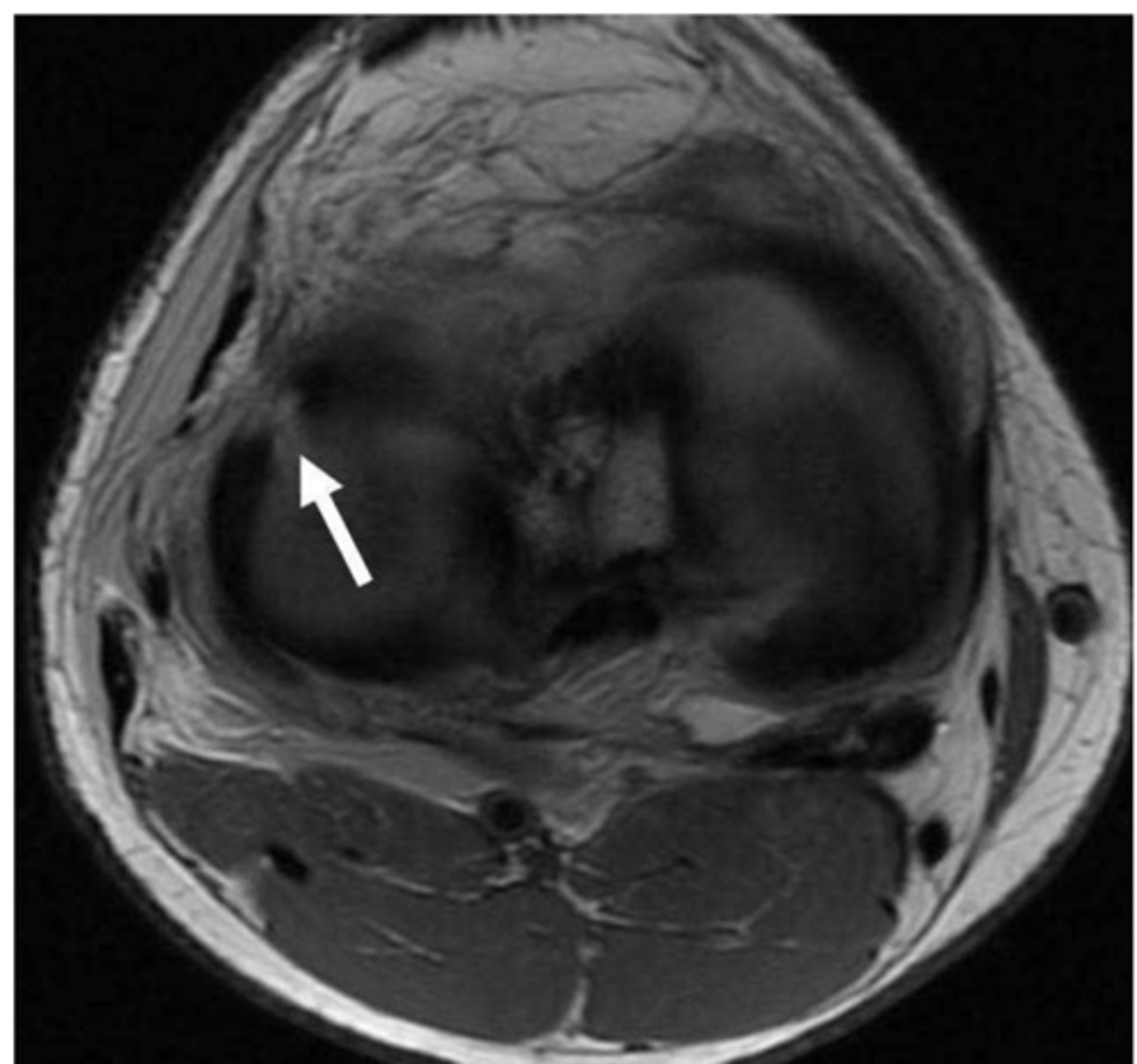 <p>Define the pathology.</p>