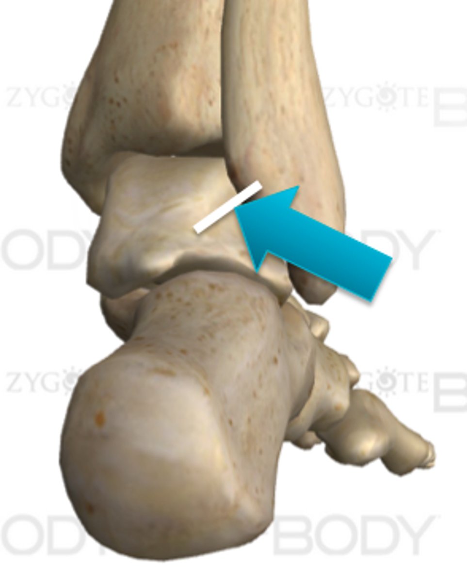 <p>Posterior talofibular ligament</p>