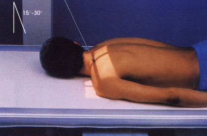 <p>PA axial (clavicle) </p><ul><li><p><span><span>CR directed caudal, 25</span><strong><em><span>°</span></em></strong><span> – 30</span><strong><em><span>° </span></em></strong></span></p></li><li><p>full inhalation&nbsp;</p></li><li><p>positioned PA erect&nbsp;</p></li></ul><p></p>