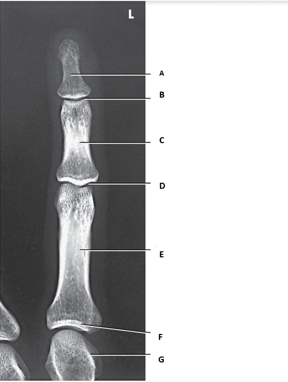 <p>What is D on PA of 3rd digit?</p>