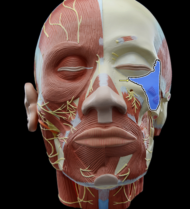 <p>Zygomatic bone</p>