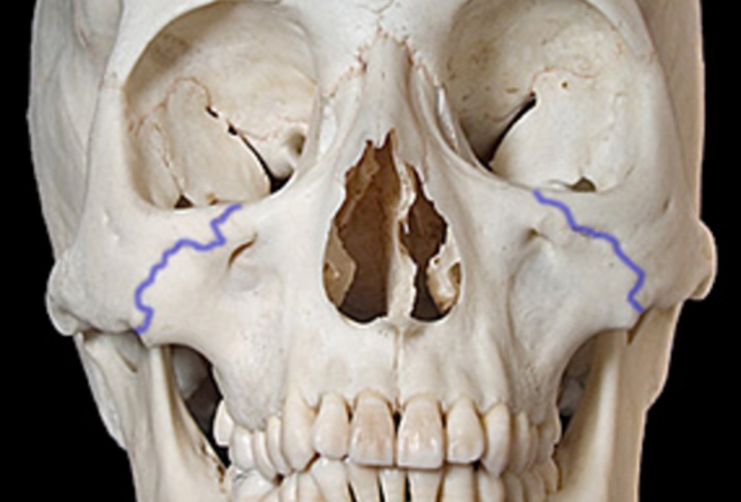 <p><em>identify the structure:</em></p>