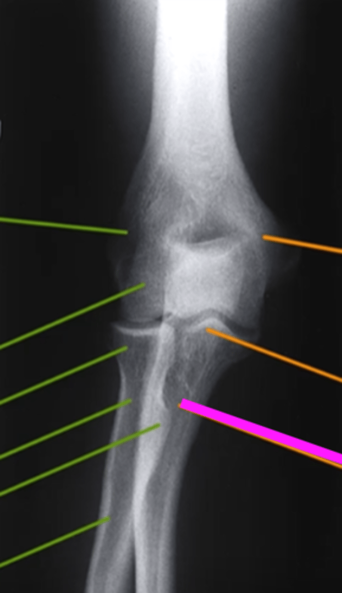 <p>what does the pink line point to?</p>