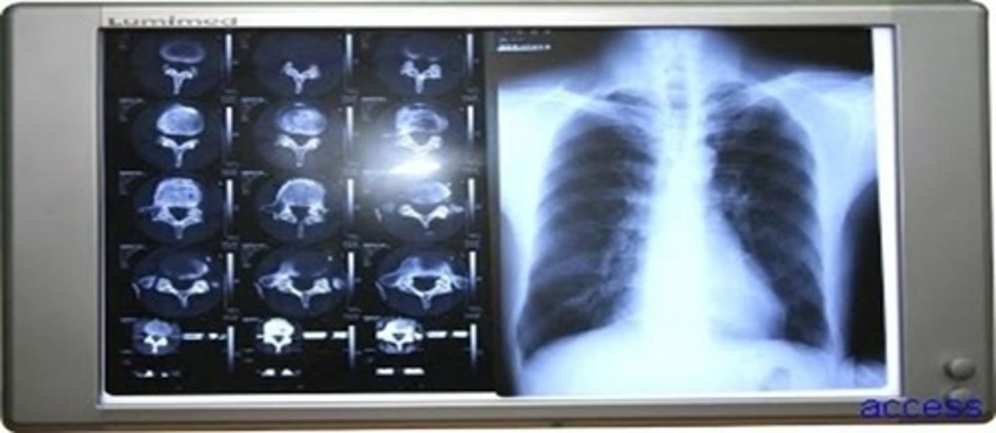 <p>Other modalities that use X-rays include CT scans and fluoroscopy.</p>