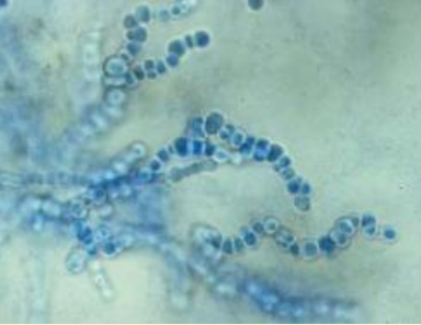 <p>What are arthrospores?</p>