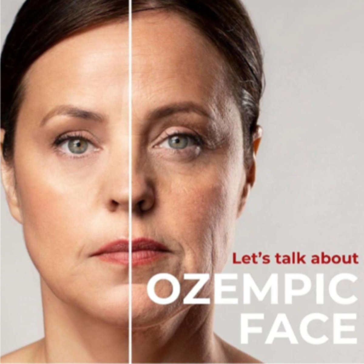 <p>(most relate to metabolic changes)</p><p>- appetite loss, followed usually by a lack of taste</p><p>- N&V, constipation</p><p>- pancreatitis, cholecystitis (inflamed gallbladder), renal failure, thyroid tumors</p><p>- appearance "ozempic face" (lose all cushion, look hollowed out)</p>