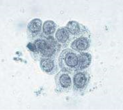 <p>These cells are present on sediment evaluation. What are they?</p>