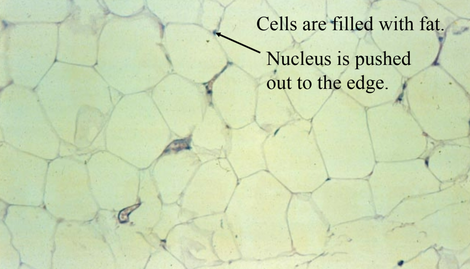 <p>Where are adipose connective tissues found?</p>