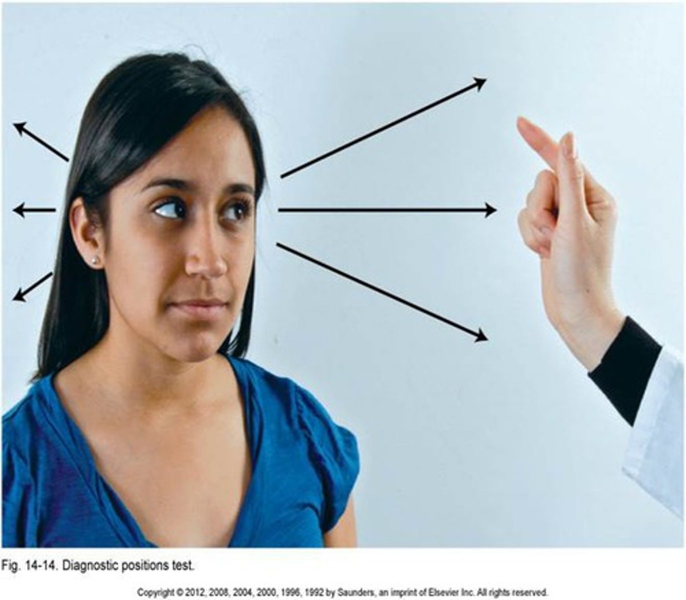 <p>can patient move eye in all directions</p>
