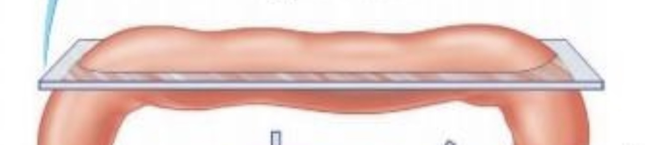 <p>a <strong>cut through the long axis</strong> of the organ</p>