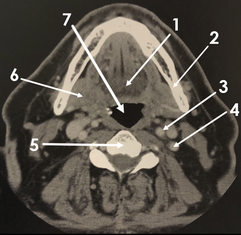 <p>1</p>