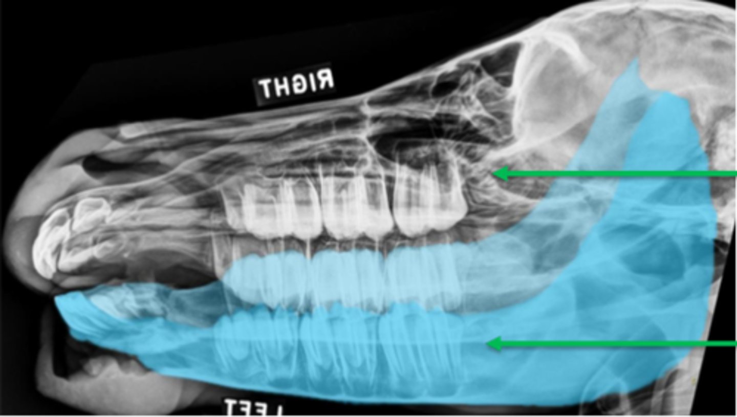 <p>on this dorsoleft-ventroright oblique view, what is the bottom arrow pointing to?</p>