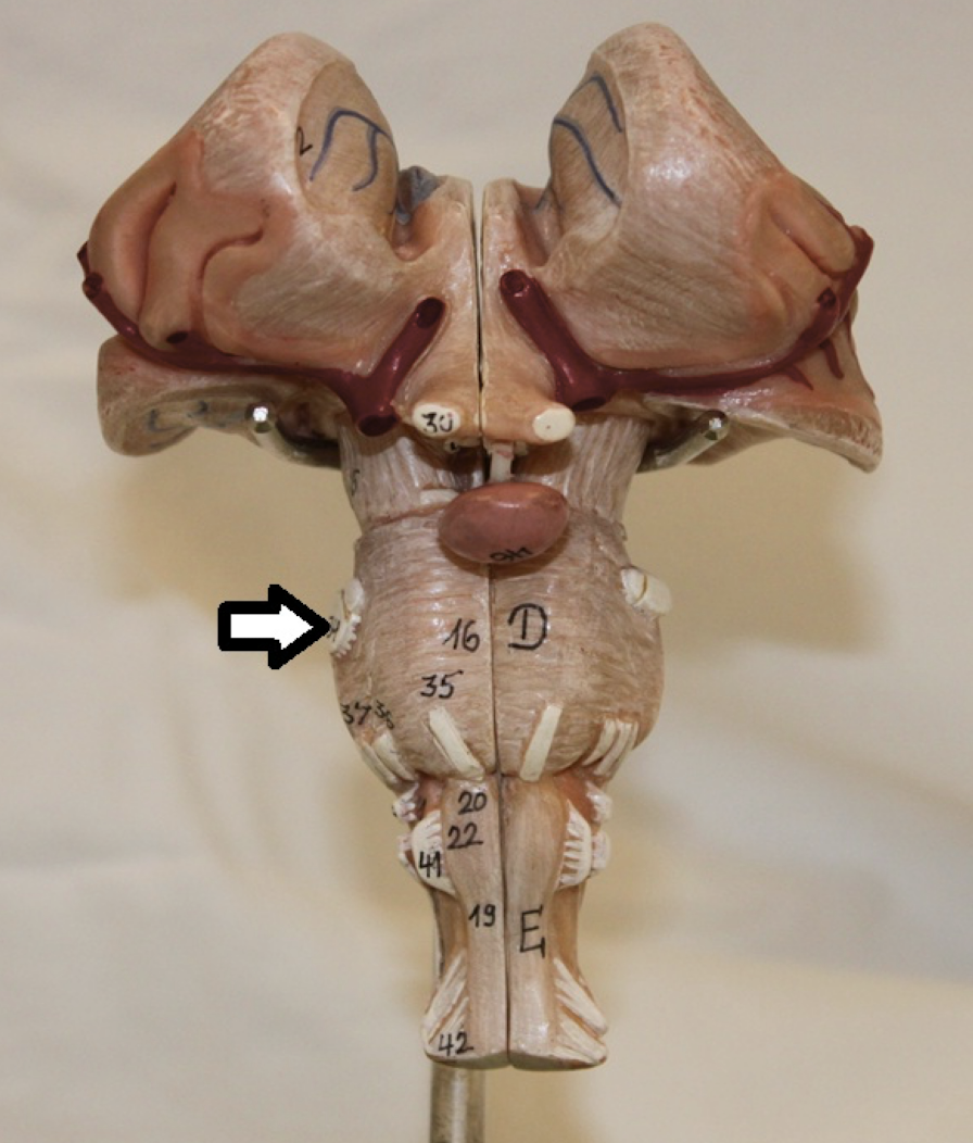 <p>name this cranial nerve</p>
