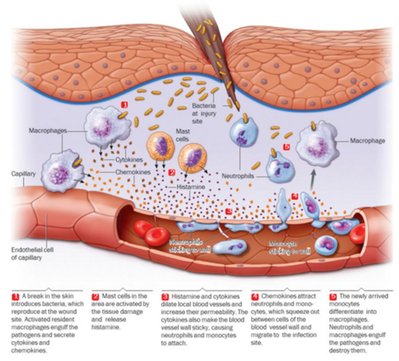 <p>Local Inflammation</p>