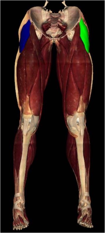 <p><strong>origin:</strong> <mark data-color="red">ASIS</mark> and anterior part of iliac crest</p><p><strong>insertion:</strong> <mark data-color="red">iliotibial tract/band (ITB)</mark>, which attaches to lateral condyle of tibia</p><p><strong>innervation:</strong> superior gluteal nerve (L4-S1)</p><p><strong>action:</strong> flexion of thigh</p>