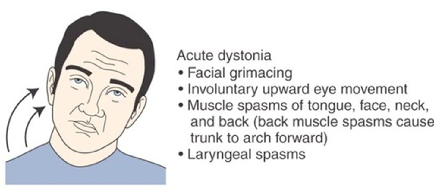 <p>A condition of abnormal muscle tone that causes slow, sustained contractions of the head and trunk</p>
