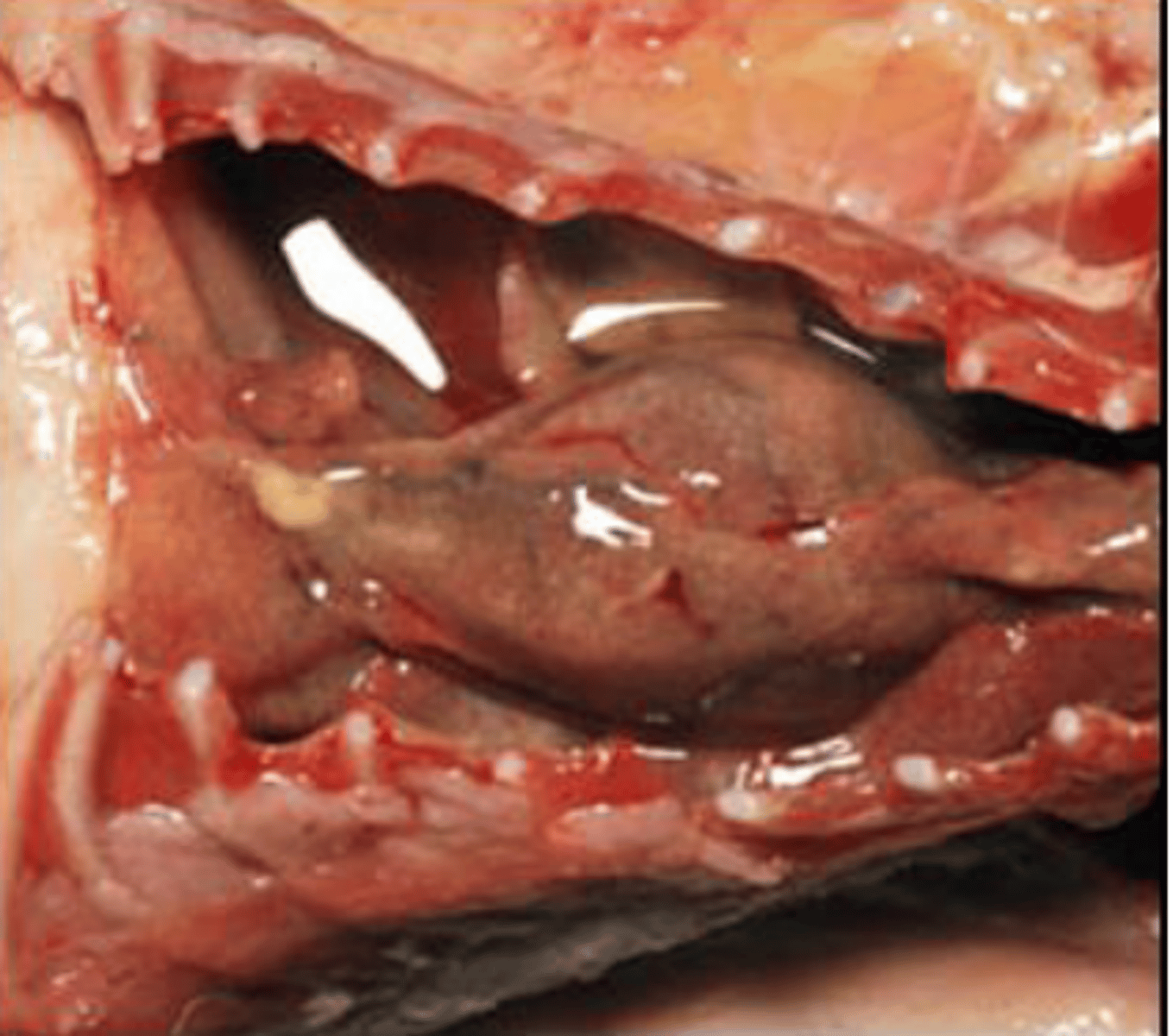 <p>what type of exudate is shown in the image?</p>