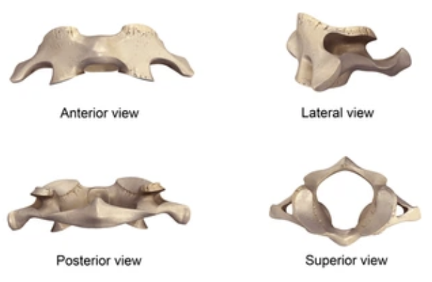 <p>What vertebrae is this?</p>