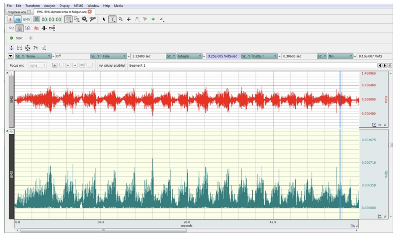 <p>The following figure depicts EMG and iEMG activity during dynamic bicep curls until the subject could not lift the weight anymore. They lifted the weight 17 times before they fatigued. Which of the following mechanism(s) are most llikely to be contributing this fatigue, given this set of data?</p><p>a) PCr depletion</p><p>b) failure to release enough calcium from the sarcoplasmic reticulum</p><p>c) an increase in Pi inside the muscle fibers</p><p>d) low dopamine levels in motor areas of the brain</p><p>e) a decrease in pH in the muscle fibers</p>