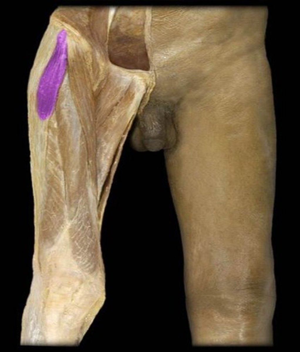 <p>What is the name of this muscle, highlighted in purple?</p>