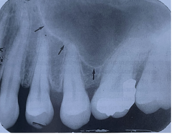 <p><span style="font-family: &quot;Times New Roman&quot;, serif">Which image is shown in this film?</span></p><ul><li><p><span style="font-family: &quot;Times New Roman&quot;, serif">frontal sinus</span></p></li><li><p><span style="font-family: &quot;Times New Roman&quot;, serif">sphenoidal sinus</span></p></li><li><p><span style="font-family: &quot;Times New Roman&quot;, serif">ethmoidal sinus</span></p></li><li><p><span style="font-family: &quot;Times New Roman&quot;, serif">maxillary sinus</span></p></li></ul><p></p>